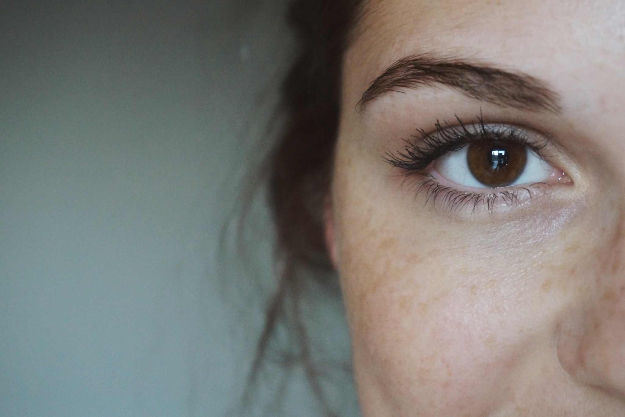 Webinar: A New Age in Cosmetic Lasers - Blue Laser: New Enhanced Skin Tightening Vascular Lesion and Photorejuvenation