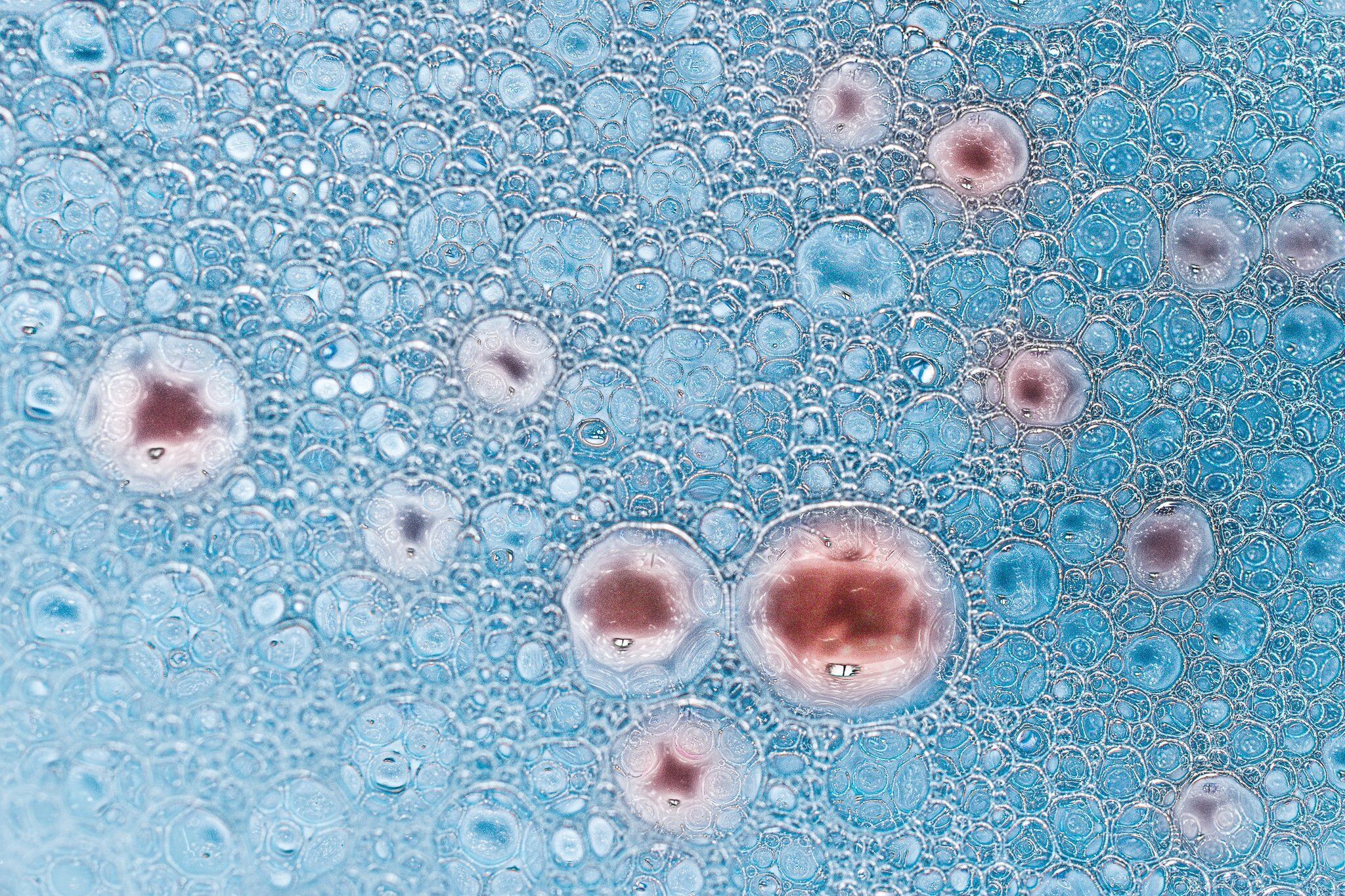 Webinar: Masterclass in Photobiomodulation (PBM) Therapy Dr Reem Hanna & Dr Stephen Barabas BMLA 2021