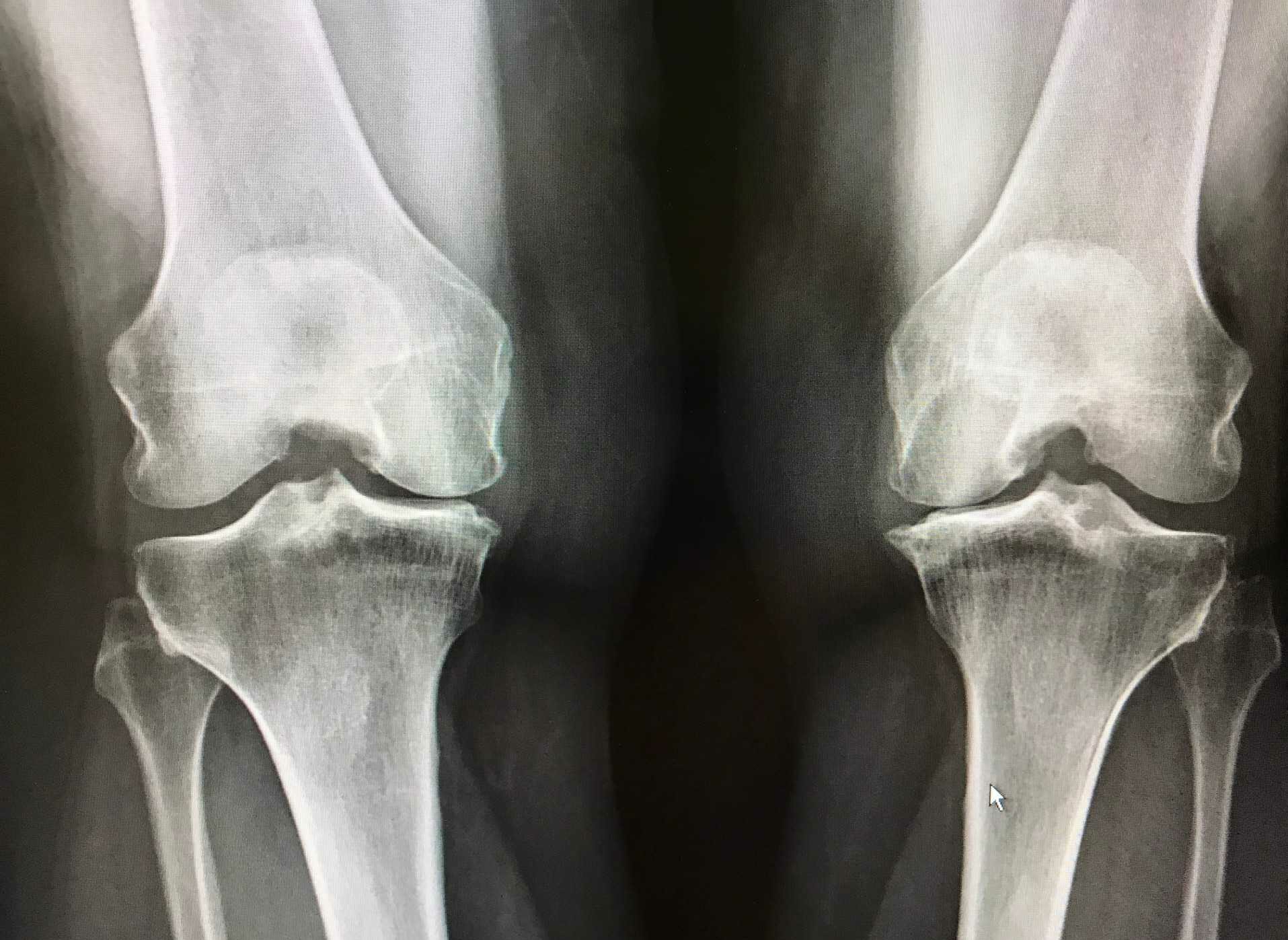 Webinar: LASER THERAPY FOR OSTEOARTHRITIS AND RHEUMATISM MANAGEMENT